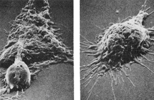Natural Immune System Devouring A Cancer Cell